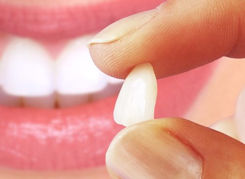 Dentística