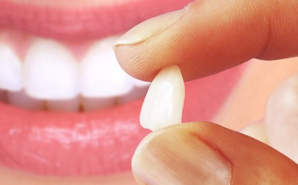 Dentística Dentística